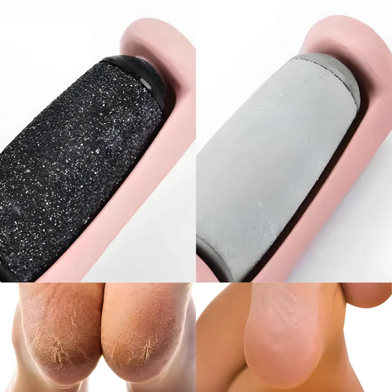 Lixa Esfoliadora Elétrica Recarregável para Pés